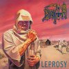 leprosy-51b1d33b7e52c.jpg