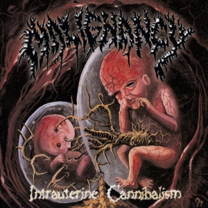 1999. MALIGNANCY. Intrauterine Cannibalism
